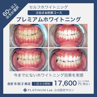 ☆専門店にお任せ☆ ホワイトニング吉祥寺のその他イメージ