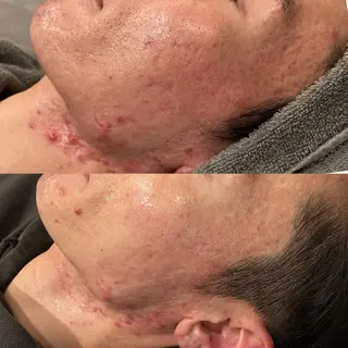 yellow.所属・yellow💛【 脱毛&フェイシャル】のエステ・リラクイメージ