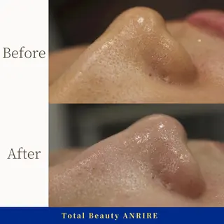 ANRIRE (アンリール)のエステ・リラクイメージ