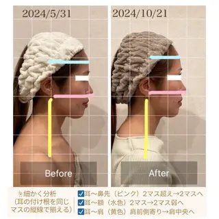 小顔×肌質改善サロン soin〔ソワン〕のエステ・リラクイメージ