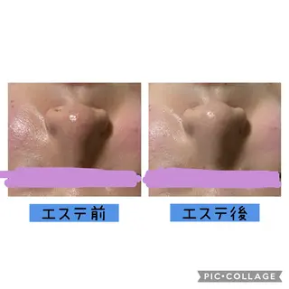 癒しと素肌ケアの サロン スリールのエステ・リラクイメージ