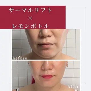 小顔矯正専門店 ❤️池田 桃花のエステ・リラクイメージ