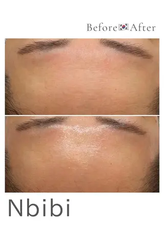 韓国🇰🇷価格 サロン_Nbibiのエステ・リラクイメージ