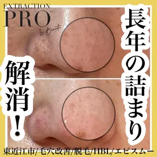 epismoo 脱毛/HBL/毛穴の眉毛・アイブロウイメージ