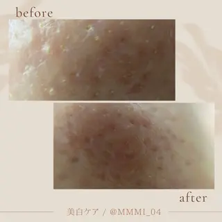 デ・アイム新潟北所属・サイトウ .のエステ・リラクイメージ