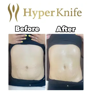 🌙🫧CHARME (RUKA)🦋🫧のネイルデザイン