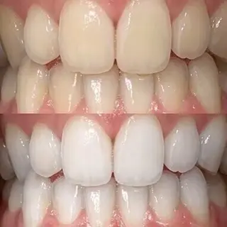 歯科提携セルフダック 宇都宮駒生店のエステ・リラクイメージ