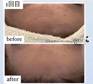 【頭痛、睡眠改善】 salon RUUのエステ・リラクイメージ