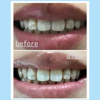 お手軽ホワイトニングsalon mina所属・武元 奈津美のその他イメージ