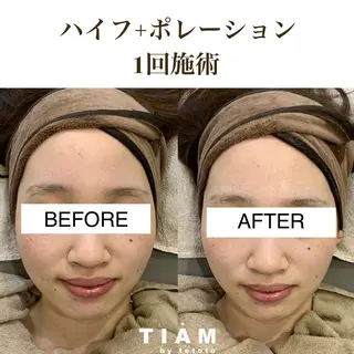 美肌サロンTIAM by tetoteのエステ・リラクイメージ