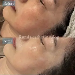 Rumia Salonのエステ・リラクイメージ