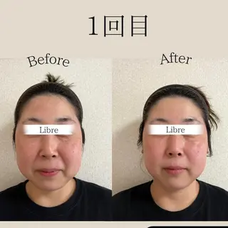 小顔コルギ&肌質改善 の専門店LIBREのエステ・リラクイメージ