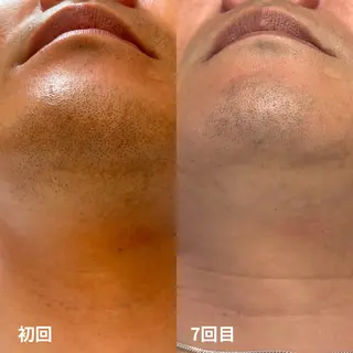 メンズ Lassy Yuriの眉毛・アイブロウイメージ