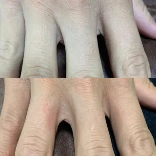 メンズ キッズ 脱毛SALON RaYNiCKのエステ・リラクイメージ