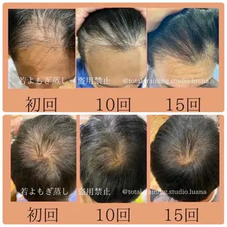 private salon Dea_maris シュガーリング&パーソナルボディケア所属・シミ改善・韓国肌管理 ボディメイク痩身のその他イメージ