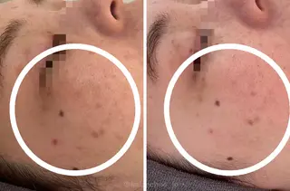 肌質改善 KALANCHOEのエステ・リラクイメージ