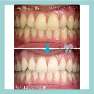 札幌ホワイトニング ラディアンス札幌駅店のその他イメージ