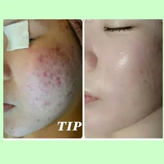 フェイシャル専門 肌質改善/プランスのエステ・リラクイメージ