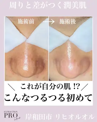 毛穴汚れ改善専門店/ 岸和田/リヒオルオルのエステ・リラクイメージ
