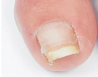 ネイル CHILO 小川のネイルデザイン