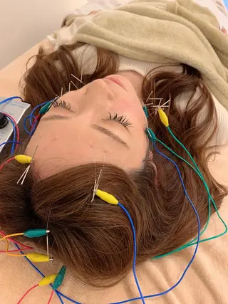 新宿hari-me所属・美容鍼hari-me 新宿のエステ・リラクイメージ