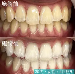 LBSホワイトニング上野店所属・LBSホワイトニング 🌐 上野店公式のエステ・リラクイメージ