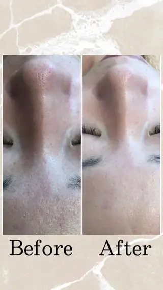 Beauty Maxのエステ・リラクイメージ