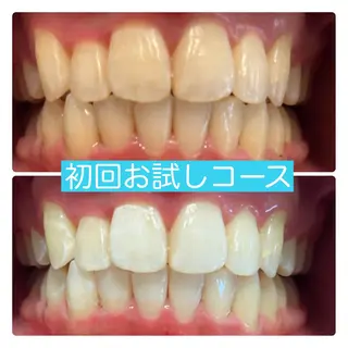 PLATINUM Beauty 横浜店所属・ホワイトニングルーム 横浜店のその他イメージ