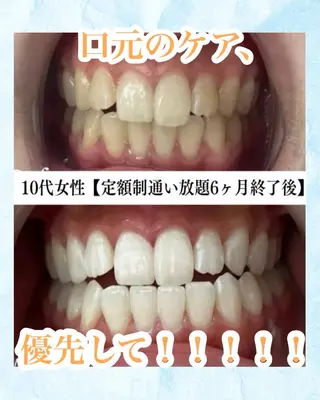 メンズ キッズ ホワイトニング専門店 WHITE天神店のエステ・リラクイメージ