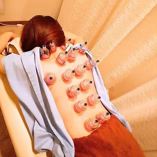 むくみたるみ専門☆ 美容鍼・小顔矯正のエステ・リラクイメージ