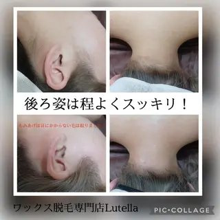 Lutella所属・ワックス脱毛専門店 Lutellaのエステ・リラクイメージ