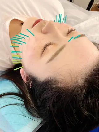 小顔美容鍼専門サロン 渋谷YZのエステ・リラクイメージ