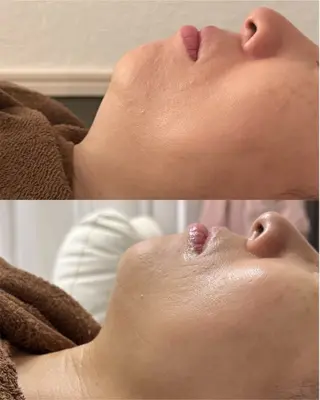 肌育×小顔×毛穴洗浄 ただののエステ・リラクイメージ