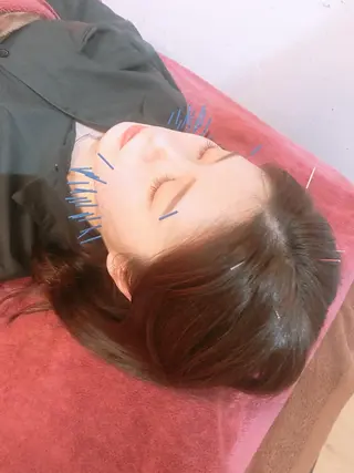美容鍼灸女性専用 りんご鍼灸治療院のその他イメージ