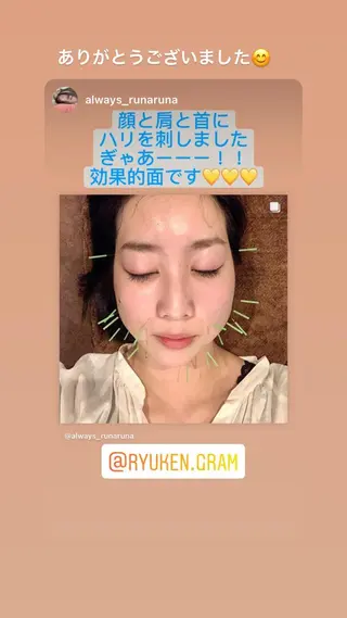 メンズ 美容鍼灸サロン LOMIHARIのエステ・リラクイメージ