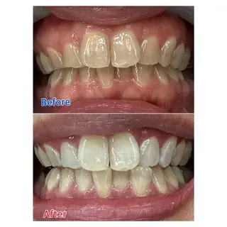 MBEAUTYSALON 千葉店・京成大久保所属・Melty 輝のその他イメージ