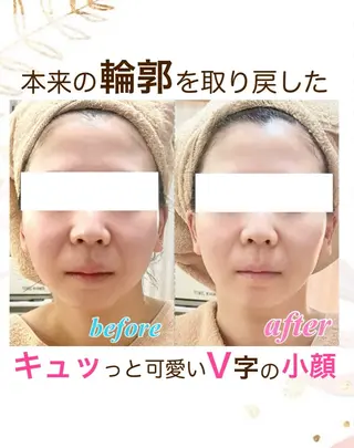 オーダーメイドエステ　ソワンドビジュー所属・美肌×小顔専門/ 亀澤いずみのエステ・リラクイメージ
