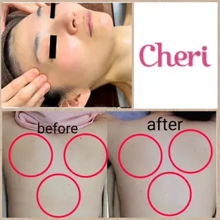 肌ケア＆毛穴洗浄 Cheriのエステ・リラクイメージ