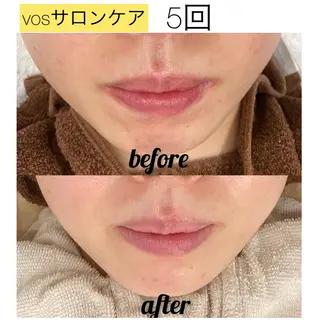 laluna saki...のその他イメージ