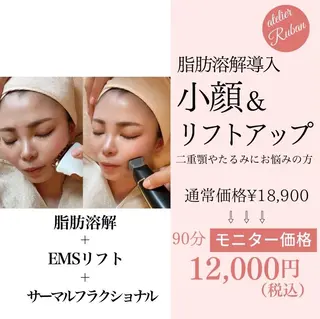毛穴/小顔専門♡ アトリエリュバンのエステ・リラクイメージ