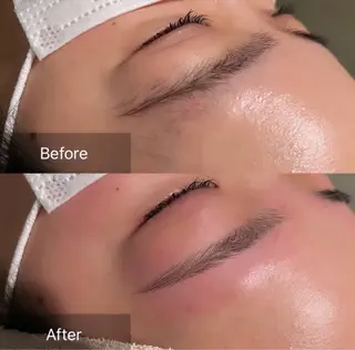 アイブロウ for woman所属・森 美優のエステ・リラクイメージ