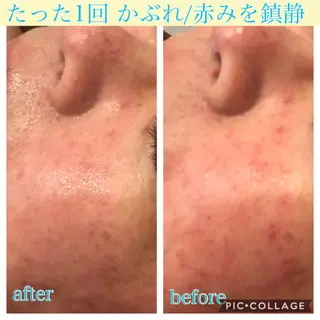 ロング カラー パーマ ヘアアレンジ キッズ ネイル マツエク・マツパ Ensor Clair所属・EnsorClair 代表 野口真央のエステ・リラクイメージ