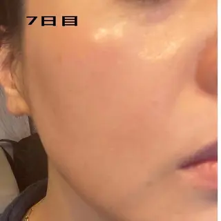 ナピュレ サロンのマツエク・マツパデザイン