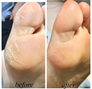 エステサロン JURISのエステ・リラクイメージ