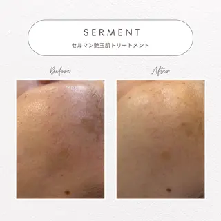 beaute LABO所属・大宮肌管理サロン sayakaのエステ・リラクイメージ