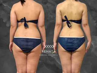 RENATA🕊 脂肪冷却専門店六本木のエステ・リラクイメージ