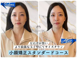 小顔矯正専門店 シンメトリー札幌のエステ・リラクイメージ