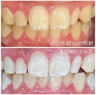 PLATINUM Beauty 横浜店所属・ホワイトニングルーム 横浜店のその他イメージ