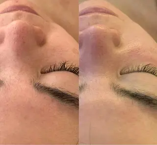 小顔&デコルテ Spa “koti”のエステ・リラクイメージ