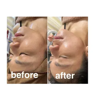 美容鍼灸サロン mahoroba院長のエステ・リラクイメージ